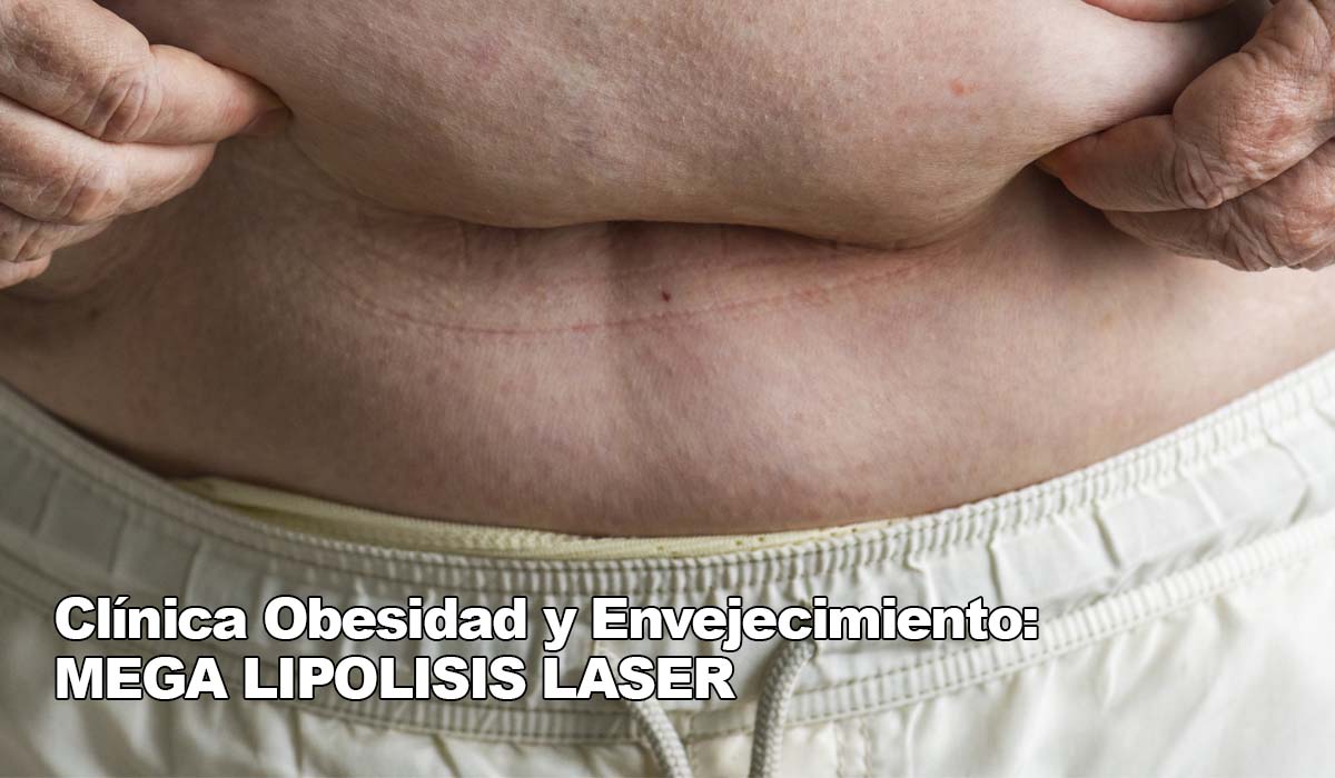 Clínica de Obesidad y Envejecimiento: Atiende desde Bogotá Lipólisis si vives en Atlántico (Colombia)